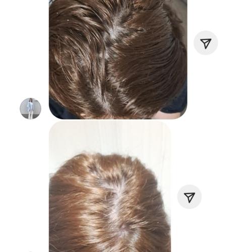 image(24) â kopija