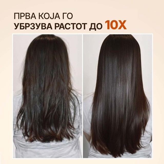 MORINGA---SLAJD---10x---MK